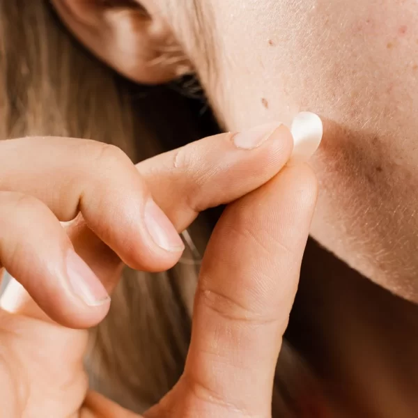 Parche Madeca21 absorbiendo fluido sobre imperfección